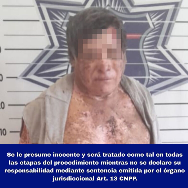 Violento individuo ataca con una motosierra a policías de Huay Pix