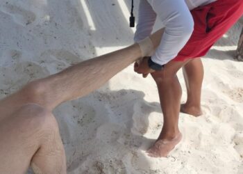 Turista sueco sufre picadura de mantarraya en Playa Las Perlas