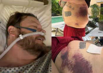 Corey Harrison, de “El Precio de la Historia”, pide ayuda tras grave accidente en Tulum