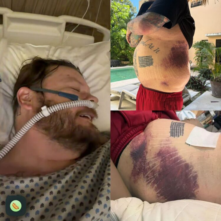 Corey Harrison, de “El Precio de la Historia”, pide ayuda tras grave accidente en Tulum