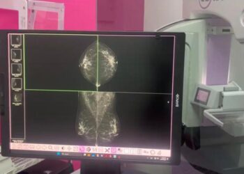 IMSS instala mastógrafo digital de última generación en Playa del Carmen