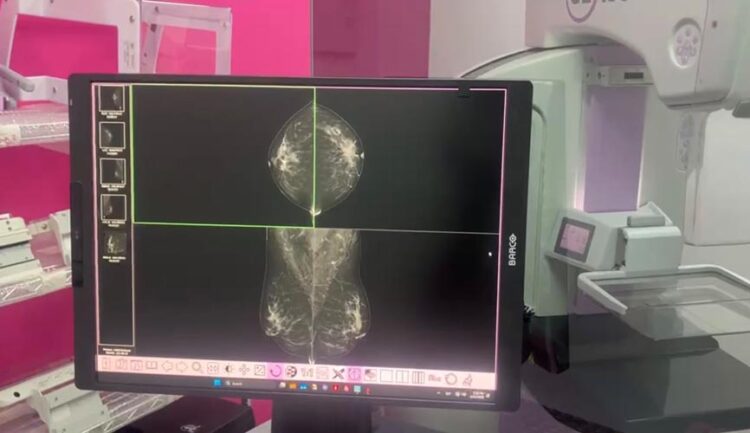 IMSS instala mastógrafo digital de última generación en Playa del Carmen